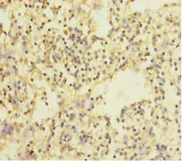 Immunohistochemistry (Formalin/PFA-fixed paraffin-embedded sections) - Anti-SLC35A1 antibody (AB230196)
