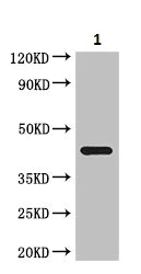 Western blot - Anti-SLC35A2 antibody (AB222854)