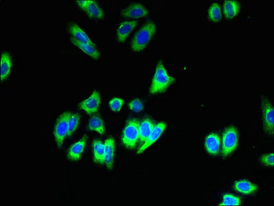 Immunocytochemistry/ Immunofluorescence - Anti-SLC35B1 antibody (AB236909)