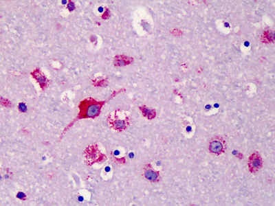 Immunohistochemistry (Formalin/PFA-fixed paraffin-embedded sections) - Anti-SLC35D1 antibody (AB113717)
