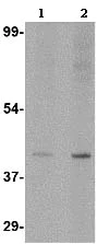 Western blot - Anti-SLC35D1 antibody (AB113717)