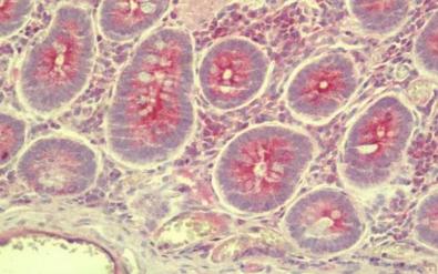 Immunohistochemistry (Formalin/PFA-fixed paraffin-embedded sections) - Anti-SLC35D3 antibody (AB211520)