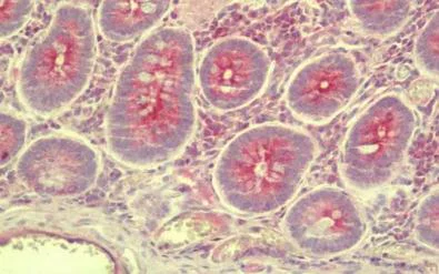 Immunohistochemistry (Formalin/PFA-fixed paraffin-embedded sections) - Anti-SLC35D3 antibody (AB211520)