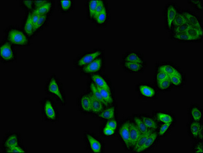 Immunocytochemistry/ Immunofluorescence - Anti-SLC37A2/Ci2 antibody (AB223048), expandable thumbnail