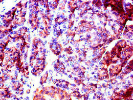 Immunohistochemistry (Formalin/PFA-fixed paraffin-embedded sections) - Anti-SLC37A2/Ci2 antibody (AB223048), expandable thumbnail