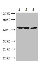 Western blot - Anti-SLC37A2/Ci2 antibody (AB223048), expandable thumbnail