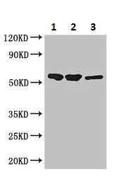 Western blot - Anti-SLC37A2/Ci2 antibody (AB223048)