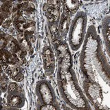 Immunohistochemistry (Formalin/PFA-fixed paraffin-embedded sections) - Anti-SLC38A10 antibody (AB121668)