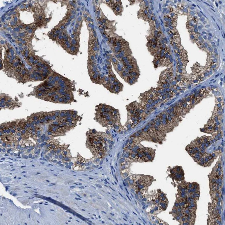 Immunohistochemistry (Formalin/PFA-fixed paraffin-embedded sections) - Anti-SLC38A6 antibody (AB121572)