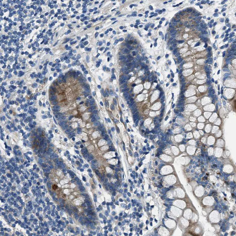 Immunohistochemistry (Formalin/PFA-fixed paraffin-embedded sections) - Anti-SLC38A6 antibody (AB121572)