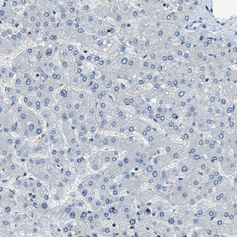 Immunohistochemistry (Formalin/PFA-fixed paraffin-embedded sections) - Anti-SLC38A6 antibody (AB121572)