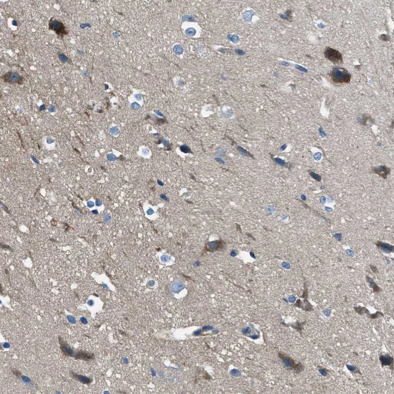 Immunohistochemistry (Formalin/PFA-fixed paraffin-embedded sections) - Anti-SLC38A6 antibody (AB121572)