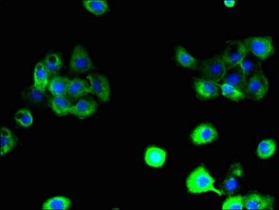 Immunocytochemistry/ Immunofluorescence - Anti-SLC38A6 antibody (AB237767)