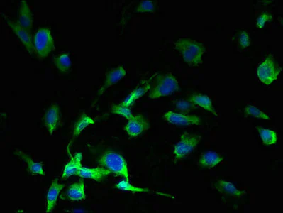 Immunocytochemistry/ Immunofluorescence - Anti-SLC38A7 antibody (AB238881)