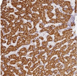 Immunohistochemistry (Formalin/PFA-fixed paraffin-embedded sections) - Anti-SLC38A9 antibody (AB130398)