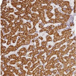 Immunohistochemistry (Formalin/PFA-fixed paraffin-embedded sections) - Anti-SLC38A9 antibody (AB130398)