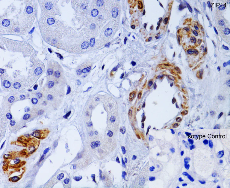 Anti-SLC39A14/ZIP-14 antibody (ab106568) | Abcam