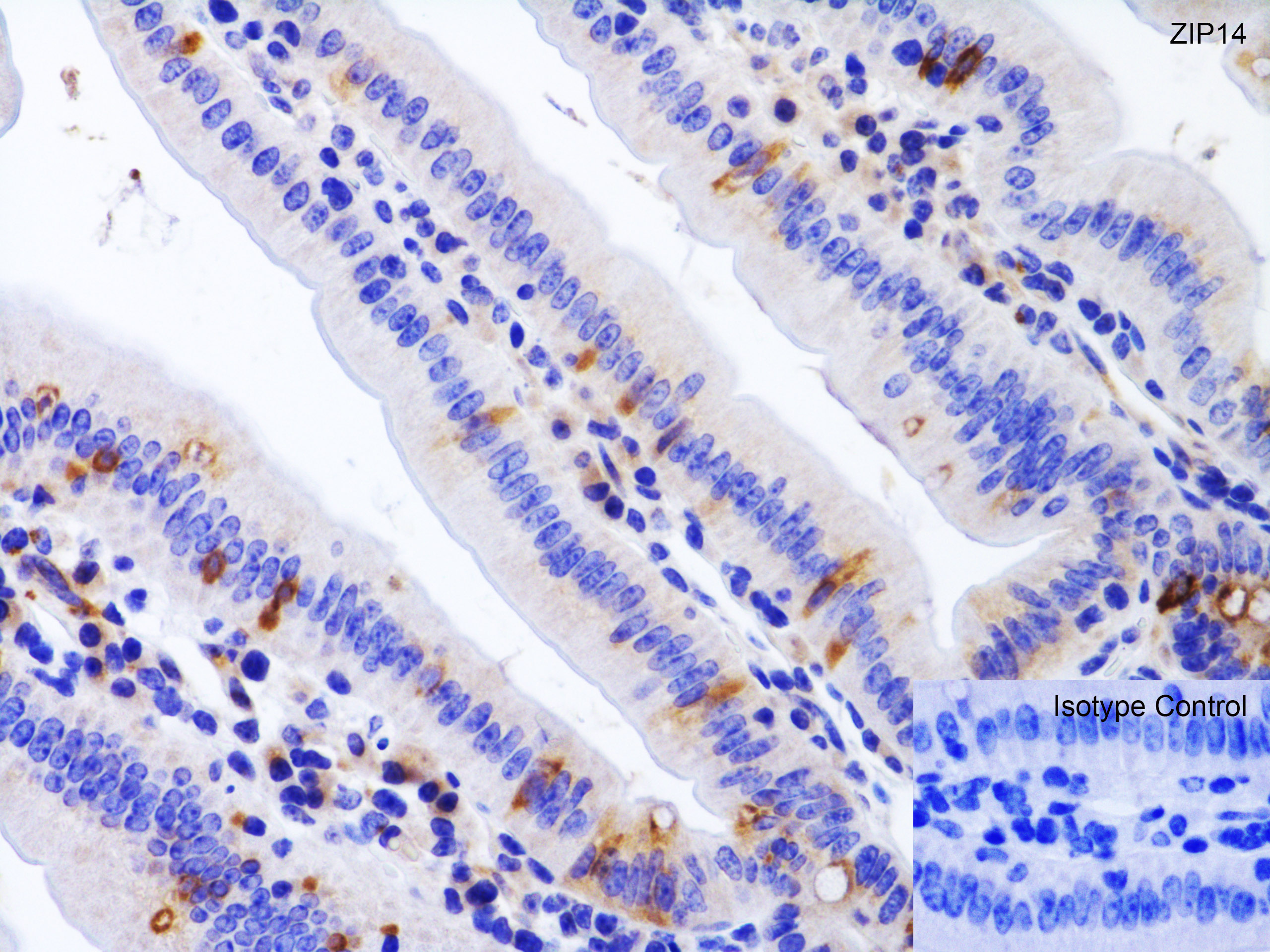 Anti-SLC39A14/ZIP-14 antibody (ab106568) | Abcam