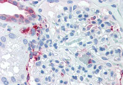 Immunohistochemistry (Formalin/PFA-fixed paraffin-embedded sections) - Anti-SLC39A14/ZIP-14 antibody (AB140973)