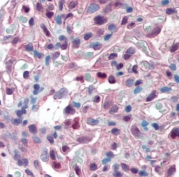 Immunohistochemistry (Formalin/PFA-fixed paraffin-embedded sections) - Anti-SLC39A14/ZIP-14 antibody (AB219174), expandable thumbnail