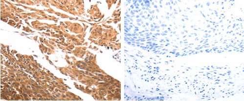 Immunohistochemistry (Formalin/PFA-fixed paraffin-embedded sections) - Anti-SLC39A6/ZIP-6 antibody (AB183101)