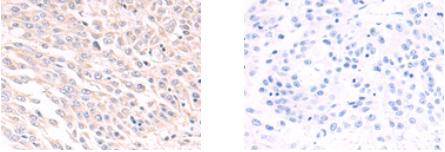 Anti-SLC39A6/ZIP-6 antibody. Rabbit polyclonal (ab183101) | Abcam
