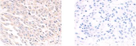 Immunohistochemistry (Formalin/PFA-fixed paraffin-embedded sections) - Anti-SLC39A6/ZIP-6 antibody (AB183101)