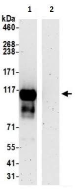 Immunoprecipitation - Anti-SLC39A6/ZIP-6 antibody (AB241205)