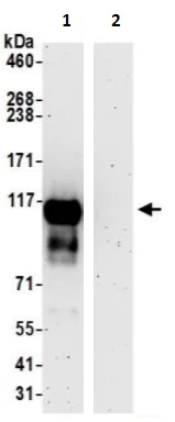 Immunoprecipitation - Anti-SLC39A6/ZIP-6 antibody (AB241205)