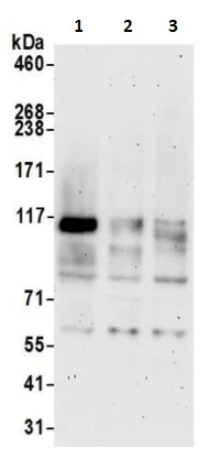 Western blot - Anti-SLC39A6/ZIP-6 antibody (AB241205)