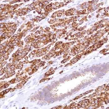 Immunohistochemistry (Formalin/PFA-fixed paraffin-embedded sections) - Anti-SLC39A6/ZIP-6 antibody [SP300] (AB227696)