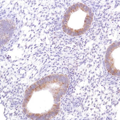 Immunohistochemistry (Formalin/PFA-fixed paraffin-embedded sections) - Anti-SLC39A6/ZIP-6 antibody [SP300] (AB227696)
