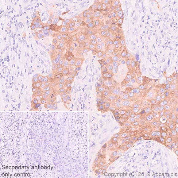 Immunohistochemistry (Formalin/PFA-fixed paraffin-embedded sections) - Anti-SLC39A6/ZIP-6 antibody [SP300] - BSA and Azide free (AB243938)