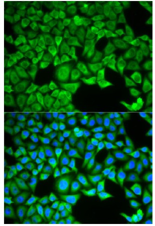 Immunocytochemistry/ Immunofluorescence - Anti-SLC3A1 antibody (AB196552)