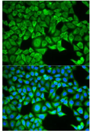 Immunocytochemistry/ Immunofluorescence - Anti-SLC3A1 antibody (AB196552)