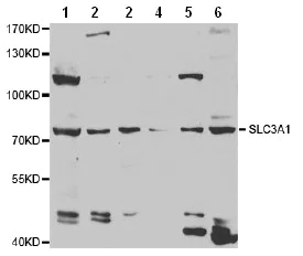 Western blot - Anti-SLC3A1 antibody (AB196552)