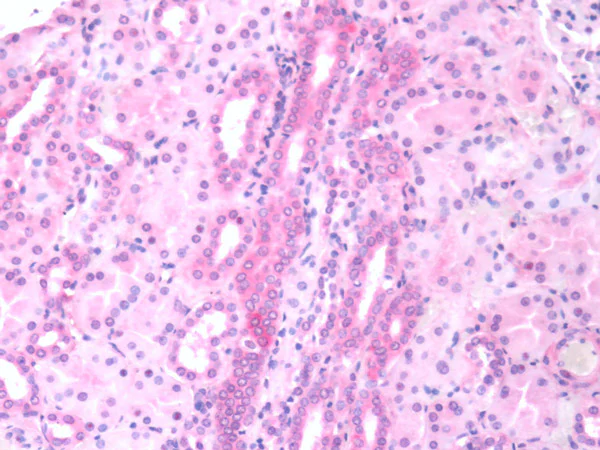 Immunohistochemistry (Formalin/PFA-fixed paraffin-embedded sections) - Anti-SLC40A1 antibody (AB78066)