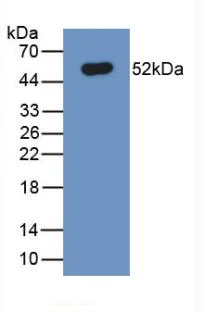 Western blot - Anti-SLC40A1 antibody [C2] (AB239583)