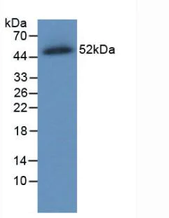 Western blot - Anti-SLC40A1 antibody [C8] (AB239511)
