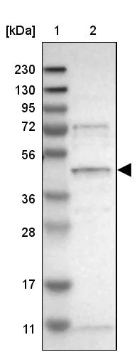 Western blot - Anti-SLC41A1 antibody (AB254754)