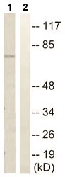 Western blot - Anti-SLC44A1/CTL1 antibody (AB110767)