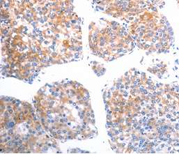Immunohistochemistry (Formalin/PFA-fixed paraffin-embedded sections) - Anti-SLC44A1/CTL1 antibody (AB198252), expandable thumbnail