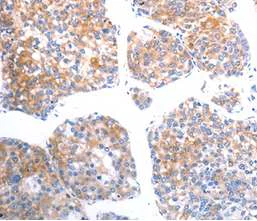 Immunohistochemistry (Formalin/PFA-fixed paraffin-embedded sections) - Anti-SLC44A1/CTL1 antibody (AB198252)