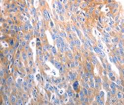 Immunohistochemistry (Formalin/PFA-fixed paraffin-embedded sections) - Anti-SLC44A1/CTL1 antibody (AB198252), expandable thumbnail