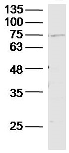 Western blot - Anti-SLC44A1/CTL1 antibody (AB217626), expandable thumbnail