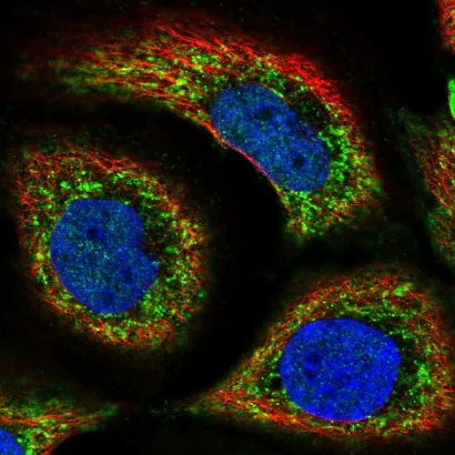 Immunocytochemistry/ Immunofluorescence - Anti-SLC44A1/CTL1 antibody (AB221460)