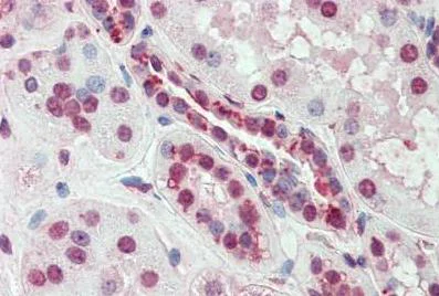 Immunohistochemistry (Formalin/PFA-fixed paraffin-embedded sections) - Anti-SLC44A2 antibody (AB133722)