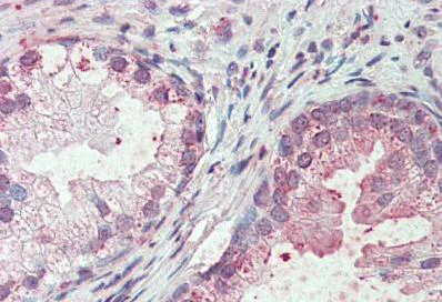 Immunohistochemistry (Formalin/PFA-fixed paraffin-embedded sections) - Anti-SLC44A2 antibody (AB133722)