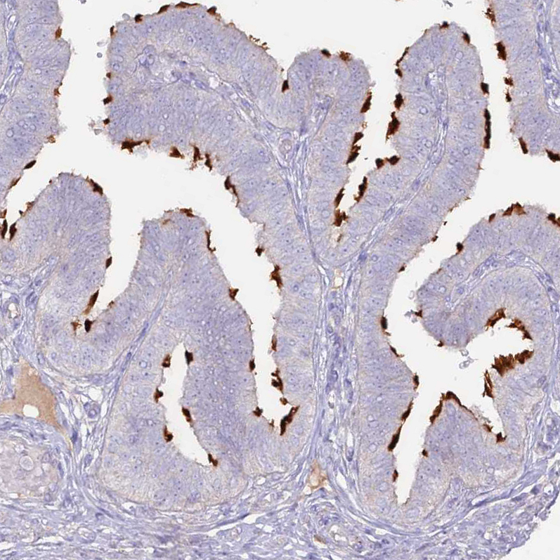 Immunohistochemistry (Formalin/PFA-fixed paraffin-embedded sections) - Anti-SLC44A4 antibody (AB188308), expandable thumbnail