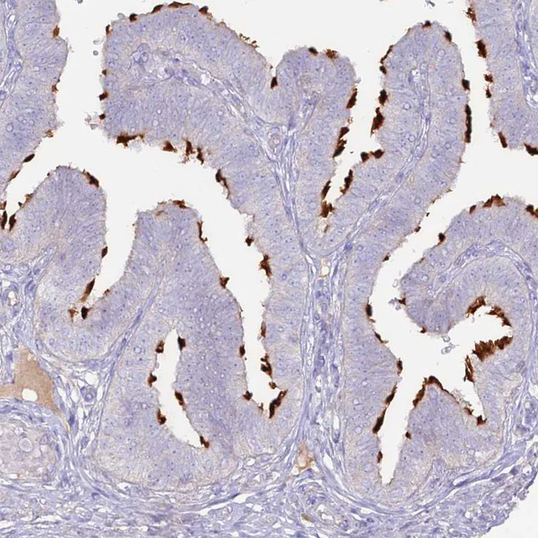 Immunohistochemistry (Formalin/PFA-fixed paraffin-embedded sections) - Anti-SLC44A4 antibody (AB188308)